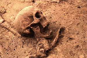 Schädel mit Gebissveränderung (Quelle: fodilus GmbH, Doris Schuller)